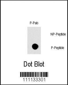 Anti-RAF1 Rabbit Polyclonal Antibody (Biotin)