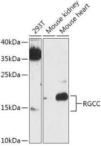 Anti-RGC-32 antibody