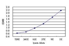 Anti-LIPA Antibody Pair