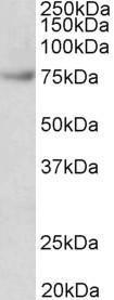 Anti-Fubp1 Antibody (A85052) (0.03 µg/ml) staining of Jurkat lysate (35 µg protein in RIPA buffer). Primary incubation was 1 hour. Detected by chemilu minescence