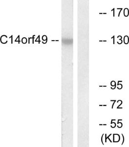 Western blot analysis of lysates from Jurkat cells using Anti-C14orf49 Antibody The right hand lane represents a negative control, where the antibody is blocked by the immunising peptide