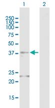 Anti-FOSB Rabbit Polyclonal Antibody