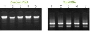 E.Z.N.A.® total DNA/RNA isolation kit