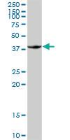 Anti-FOSB Rabbit Polyclonal Antibody