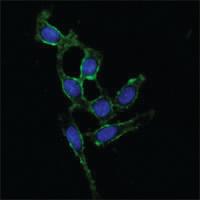 Anti-PTK2 Mouse Monoclonal Antibody [clone: 10H7E9]