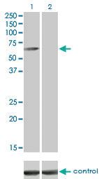 Anti-CAMKK1 Mouse Monoclonal Antibody [clone: 1F6]