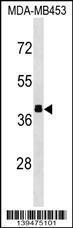 Anti-ALDOB Rabbit Polyclonal Antibody (APC (Allophycocyanin))