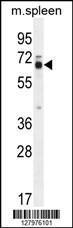 Anti-LMOD2 Rabbit Polyclonal Antibody (HRP (Horseradish Peroxidase))