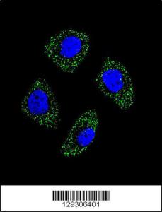 Anti-EDN1 Rabbit Polyclonal Antibody