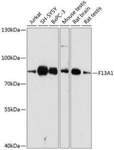 Antibody anti-F13A1 100 µl