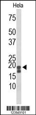 Anti-IMPDH1 Rabbit Polyclonal Antibody