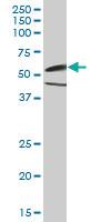 Anti-CAMK2G Mouse Polyclonal Antibody