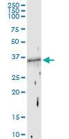 Anti-FOSB Rabbit Polyclonal Antibody