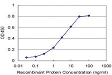 Anti-SCAMP3 Mouse Monoclonal Antibody [clone: 1F6]