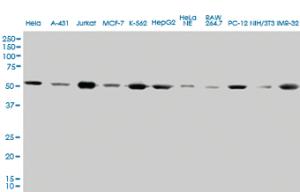 Anti-TUBA4A Mouse Monoclonal Antibody [clone: 2E11]