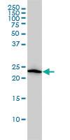 Anti-VBP1 Mouse Monoclonal Antibody [clone: 3D11]