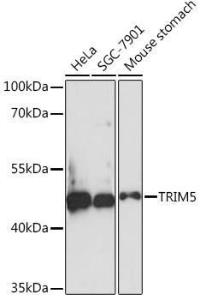 Western blot analysis of extracts of various cell lines, using Anti-TRIM5 alpha Antibody (A93141) at 1:1,000 dilution. The secondary antibody was Goat Anti-Rabbit IgG H&L Antibody (HRP) at 1:10,000 dilution.