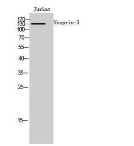 Western blot analysis of Jurkat cells using Anti-C14orf49 Antibody