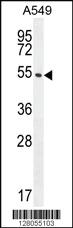 Anti-CIART Rabbit Polyclonal Antibody