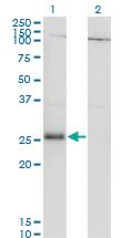 Anti-RNF138 Mouse Monoclonal Antibody [clone: 3G2]