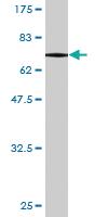 Anti-PIK3R1 Mouse Monoclonal Antibody [clone: 3C11]