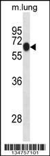 Anti-DYRK1B Rabbit Polyclonal Antibody (FITC (Fluorescein Isothiocyanate))