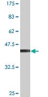 Anti-VDAC1 Mouse Monoclonal Antibody [clone: 2E10]