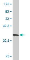 Anti-PKP4 Mouse Monoclonal Antibody [clone: 1B11]