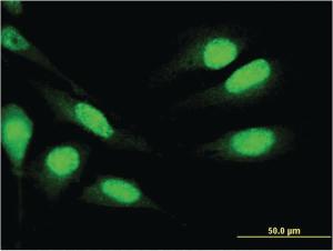 Anti-MNDA Mouse Monoclonal Antibody [clone: 1H2]