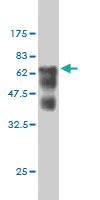 Anti-SMS Mouse Monoclonal Antibody [clone: 1G6]