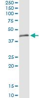 Anti-TRIM63 Polyclonal Antibody Pair