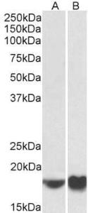 Anti-ARF4 antibody