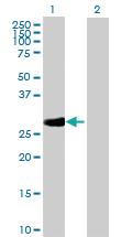 Anti-RPA4 Mouse Polyclonal Antibody