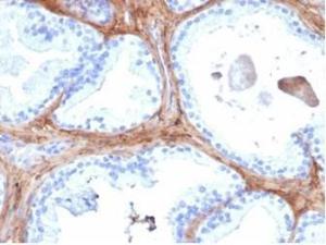 Immunohistochemical analysis of formalin-fixed, paraffin-embedded human prostate tissue using Anti-Decorin Antibody [DCN/6289]