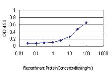 Anti-CAMKK1 Mouse Monoclonal Antibody [clone: 1F6]