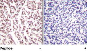 Anti-BLM Rabbit Polyclonal Antibody