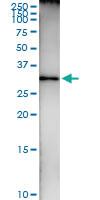 Anti-HADH Polyclonal Antibody Pair