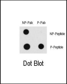 Anti-RAF1 Rabbit Polyclonal Antibody