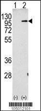 Anti-APP Rabbit Polyclonal Antibody (HRP (Horseradish Peroxidase))