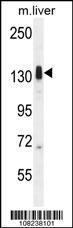 Anti-LMTK3 Rabbit Polyclonal Antibody (FITC (Fluorescein Isothiocyanate))