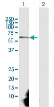 Anti-CAMK2G Rabbit Polyclonal Antibody