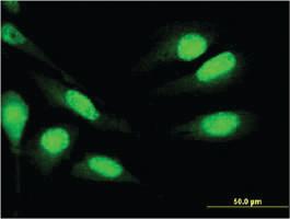 Anti-MNDA Mouse Monoclonal Antibody [clone: 1H2]