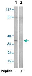 Anti-ACKR4 Rabbit Polyclonal Antibody