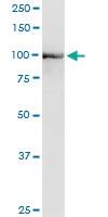 Anti-PDCD6IP Polyclonal Antibody Pair