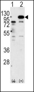 Anti-APP Rabbit Polyclonal Antibody (AP (Alkaline Phosphatase))