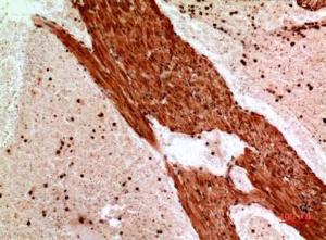 Immunohistochemical analysis of paraffin-embedded mouse heart using Anti-ANGPTL1 Antibody