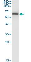 Anti-CAMK2G Rabbit Polyclonal Antibody