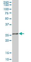 Anti-RPA4 Mouse Polyclonal Antibody