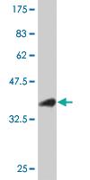 Anti-TAOK3 Mouse Monoclonal Antibody [clone: 3D11]