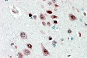 Anti-NOVA1 Antibody (A83421) (25 µg/ml) staining of paraffin embedded Human Cerebral Cortex Steamed antigen retrieval with citrate buffer pH 6, AP-staining